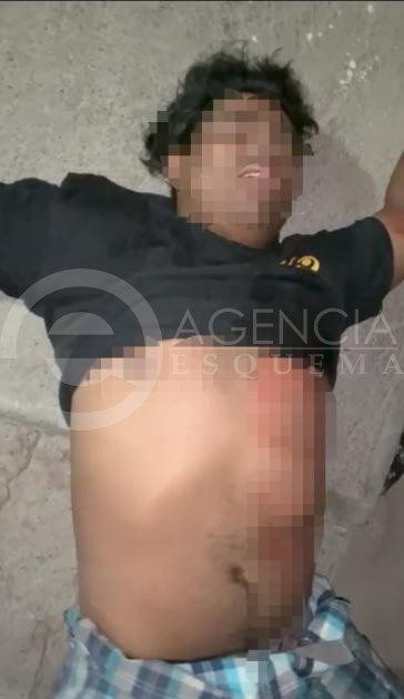 Hieren con una arma blanca a sujeto en Apatzingán